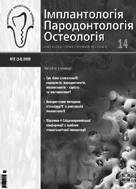 фото: Імплантологія. Пародонтологія. Остеологія